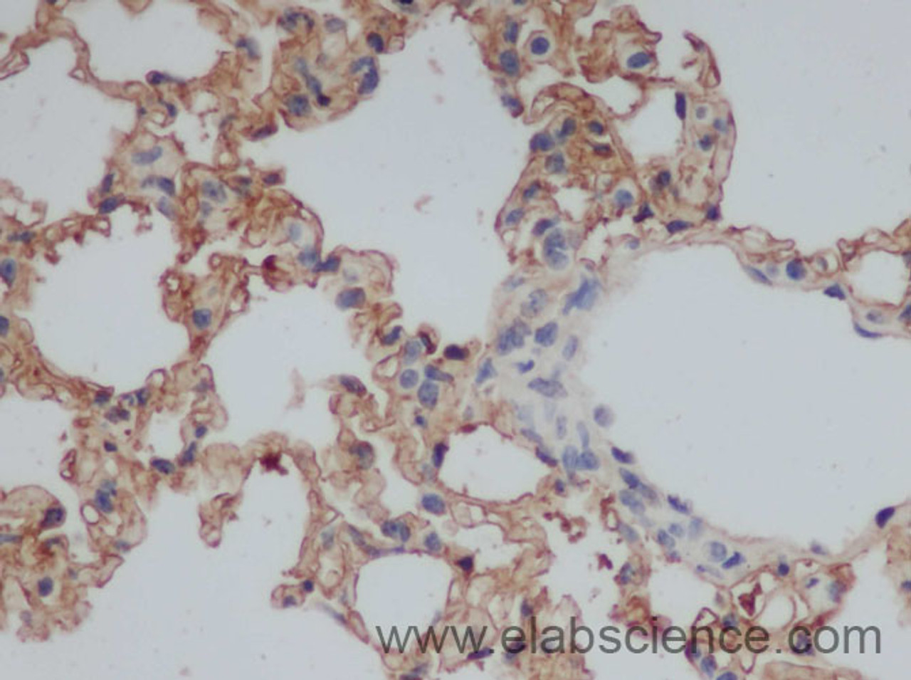 Immunohistochemistry of paraffin-embedded Rat lung using CD244 Polyclonal Antibody at dilution of 1:50