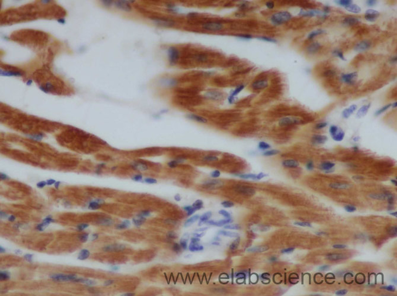 Immunohistochemistry of paraffin-embedded Rat heart using TNNT2 Polyclonal Antibody at dilution of 1:50