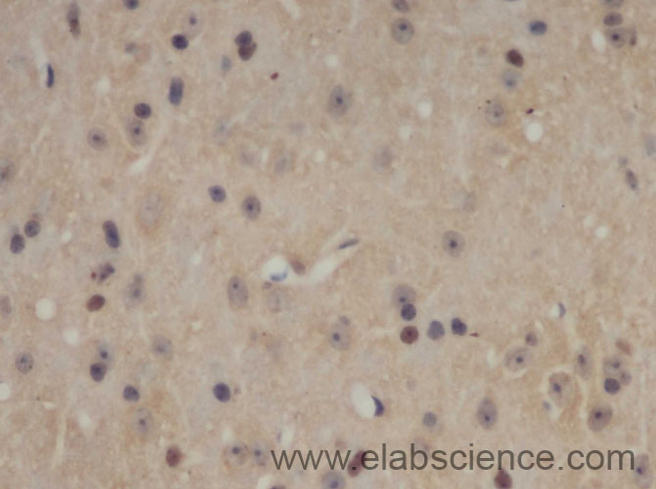 Immunohistochemistry of paraffin-embedded Mouse brain using SOX-2 Polyclonal Antibody at dilution of 1:50