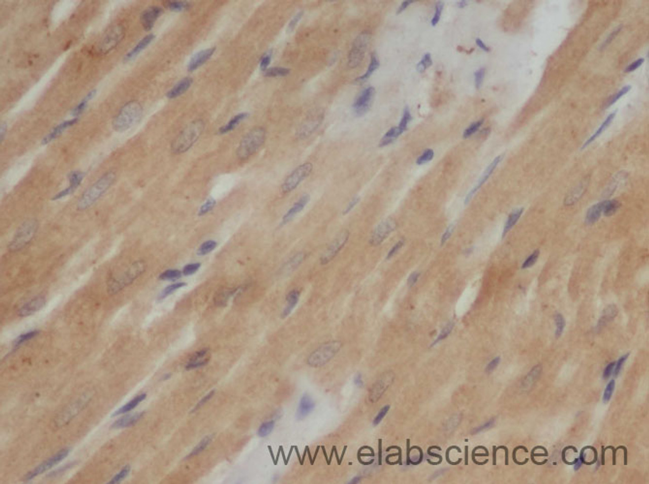 Immunohistochemistry of paraffin-embedded Rat heart using AB42 Polyclonal Antibody at dilution of 1:50