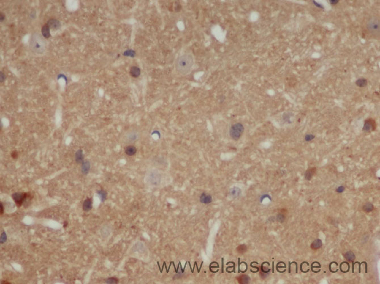 Immunohistochemistry of paraffin-embedded Mouse brain using AB42 Polyclonal Antibody at dilution of 1:50