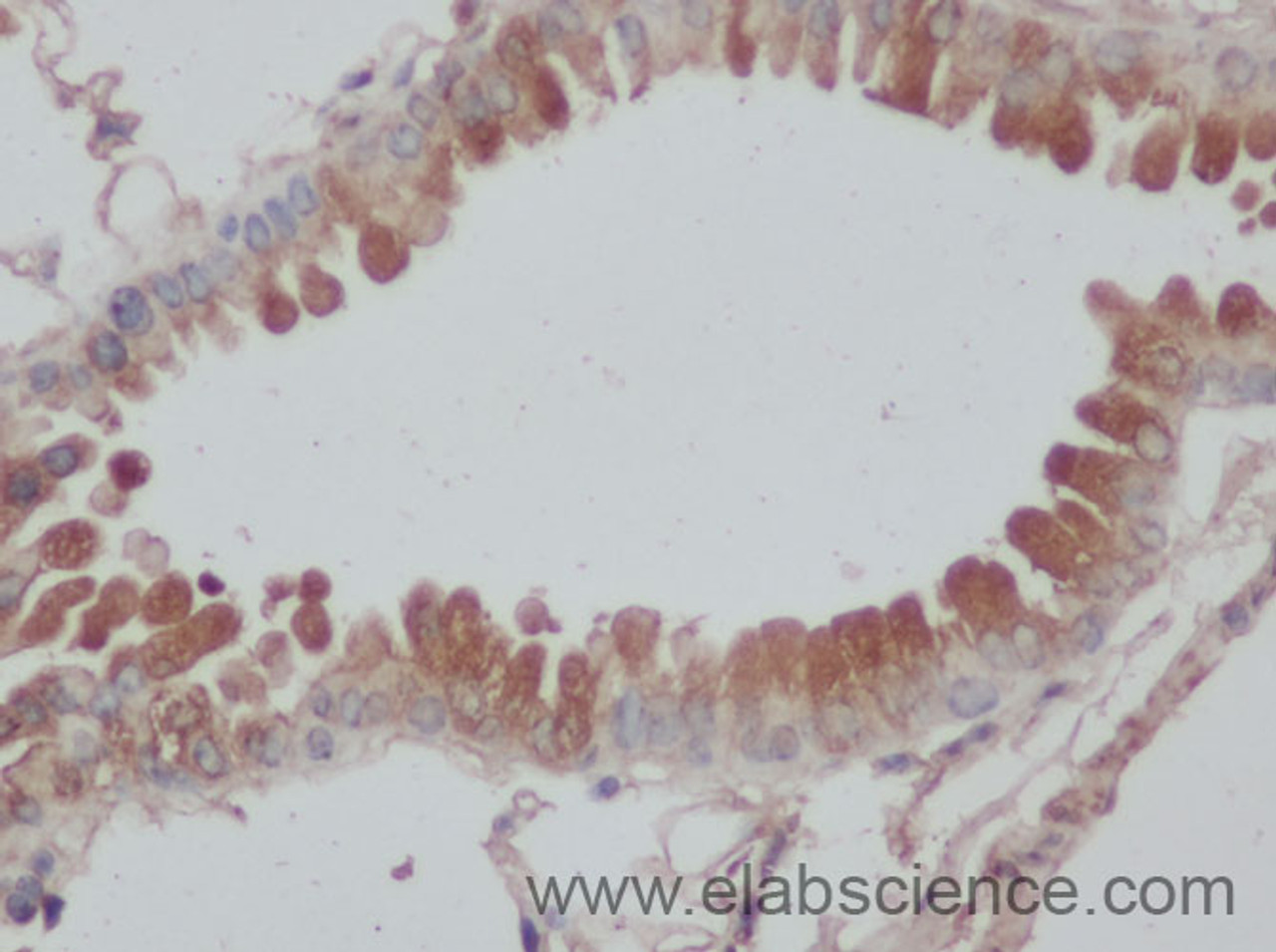 Immunohistochemistry of paraffin-embedded Rat lung using DNAL1 Polyclonal Antibody at dilution of 1:50