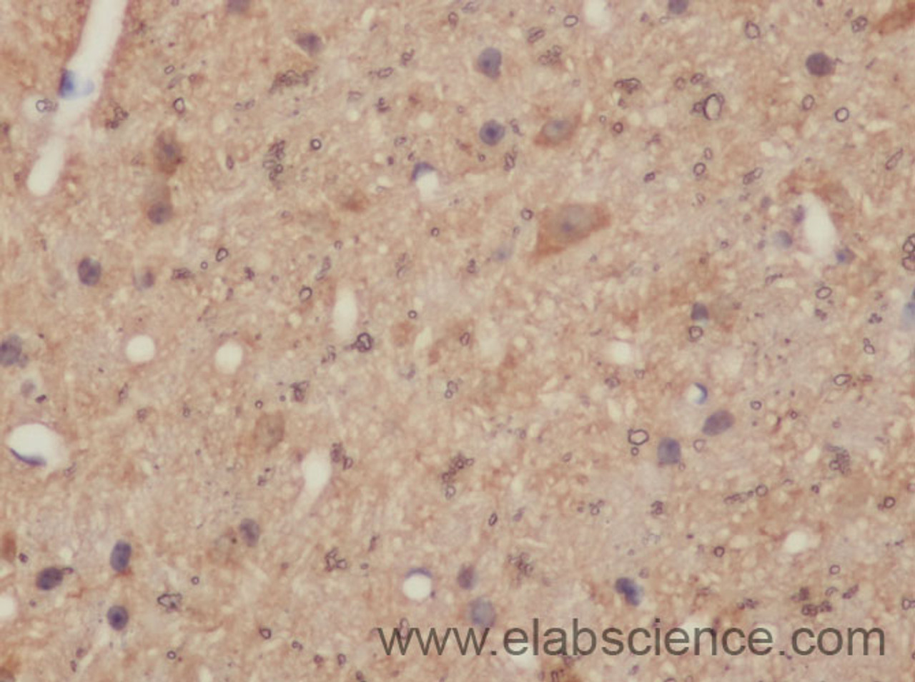 Immunohistochemistry of paraffin-embedded Mouse brain using DNAL1 Polyclonal Antibody at dilution of 1:50