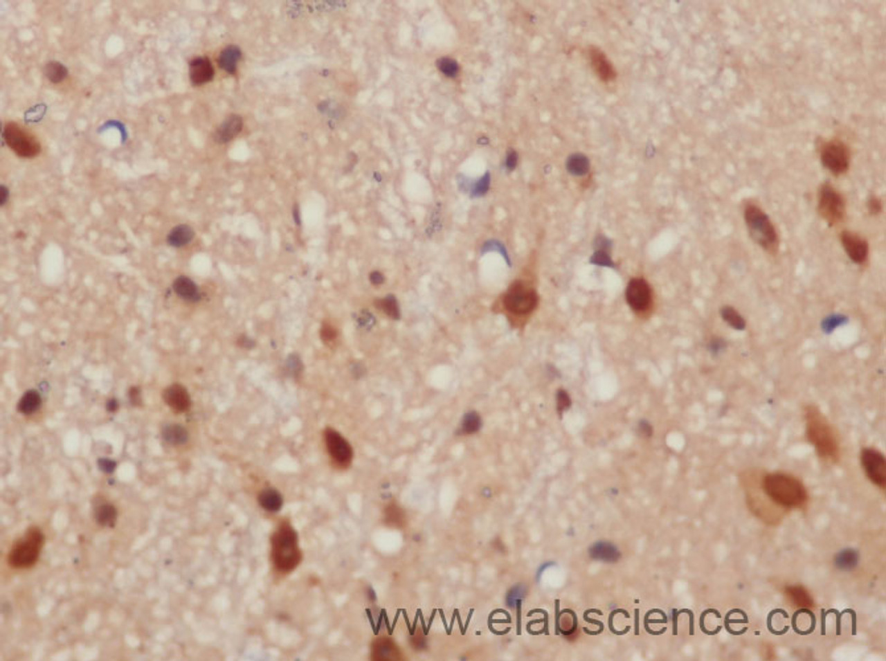 Immunohistochemistry of paraffin-embedded Mouse brain using CXCL14 Polyclonal Antibody at dilution of 1:50