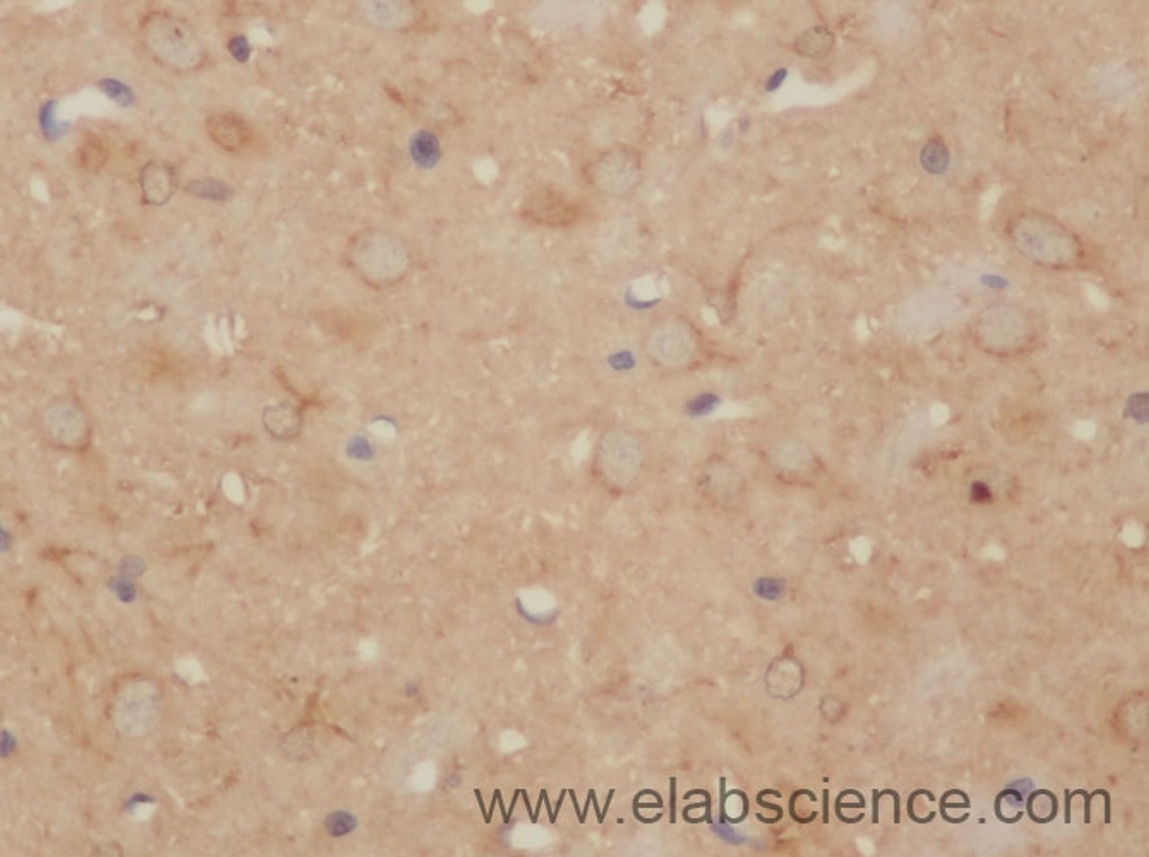 Immunohistochemistry of paraffin-embedded Rat brain using CD86 Polyclonal Antibody at dilution of 1:50