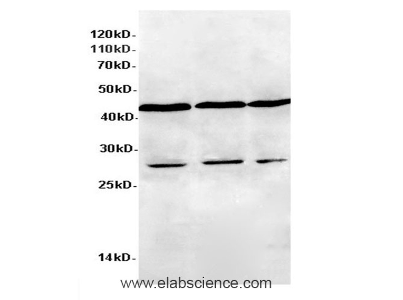 Western Blot analysis of HeLa, 293Tand Jurkat cells using ASCC1 Polyclonal Antibody at dilution of 1:600
