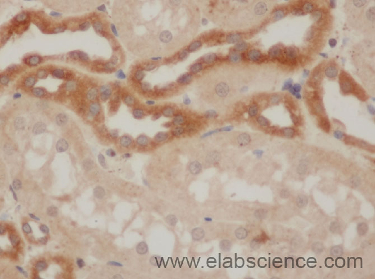 Immunohistochemistry of paraffin-embedded Rat kidney using IkB alpha Polyclonal Antibody at dilution of 1:50