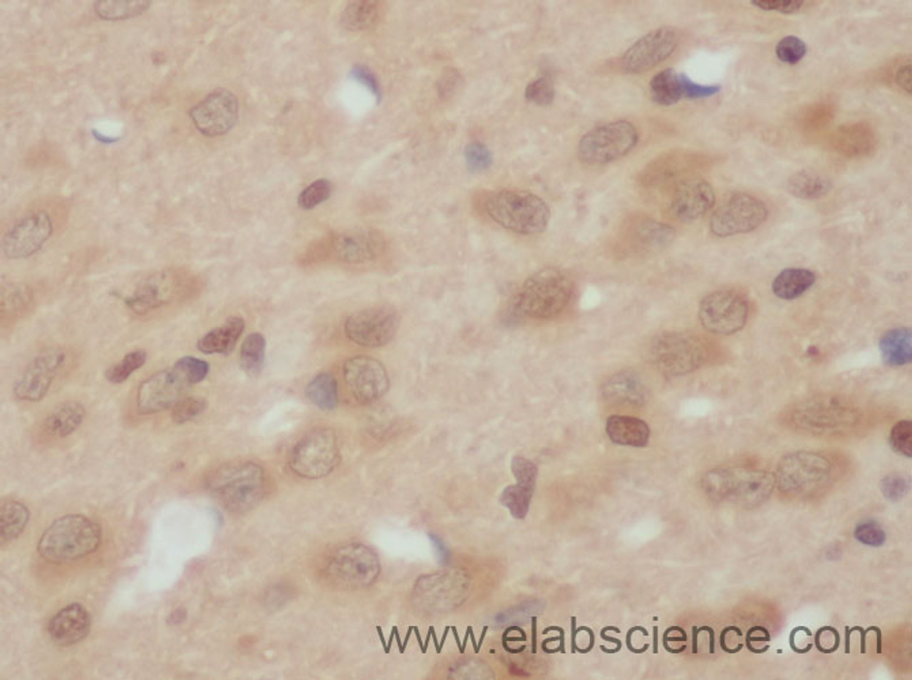 Immunohistochemistry of paraffin-embedded Rat Hippocampe using JNK1 Polyclonal Antibody at dilution of 1:50