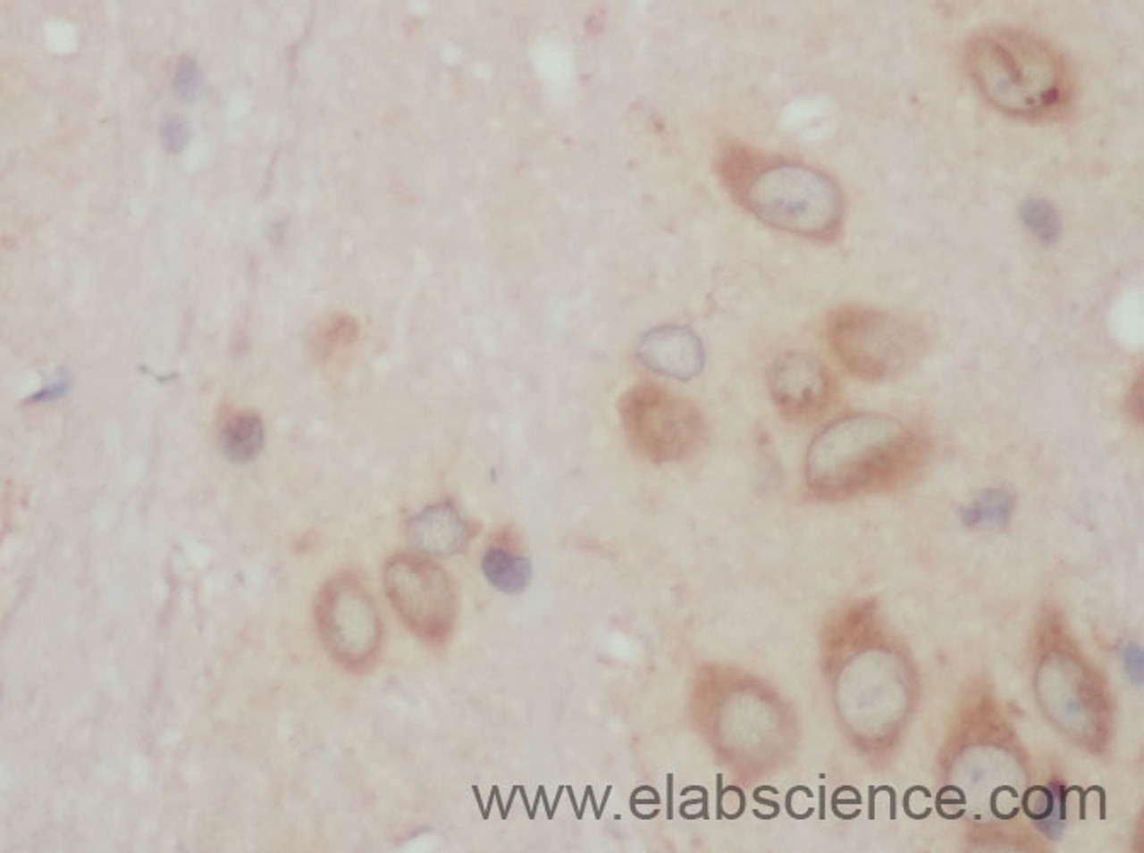 Immunohistochemistry of paraffin-embedded Mouse brain using ACSBG1 Polyclonal Antibody at dilution of 1:50