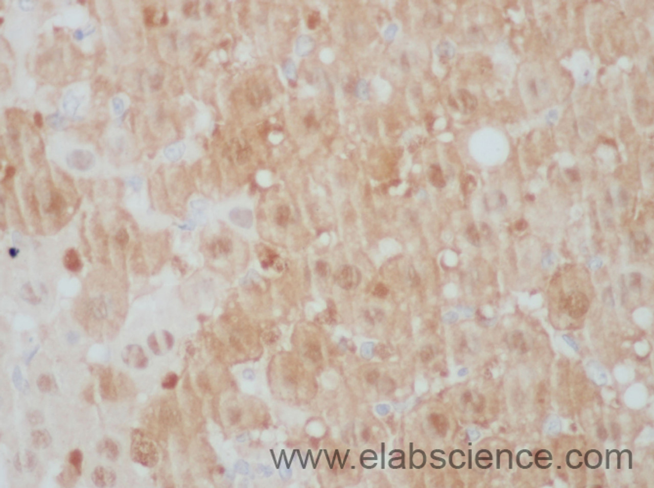 Immunohistochemistry of paraffin-embedded Mouse liver using ARG2 Polyclonal Antibody at dilution of 1:50