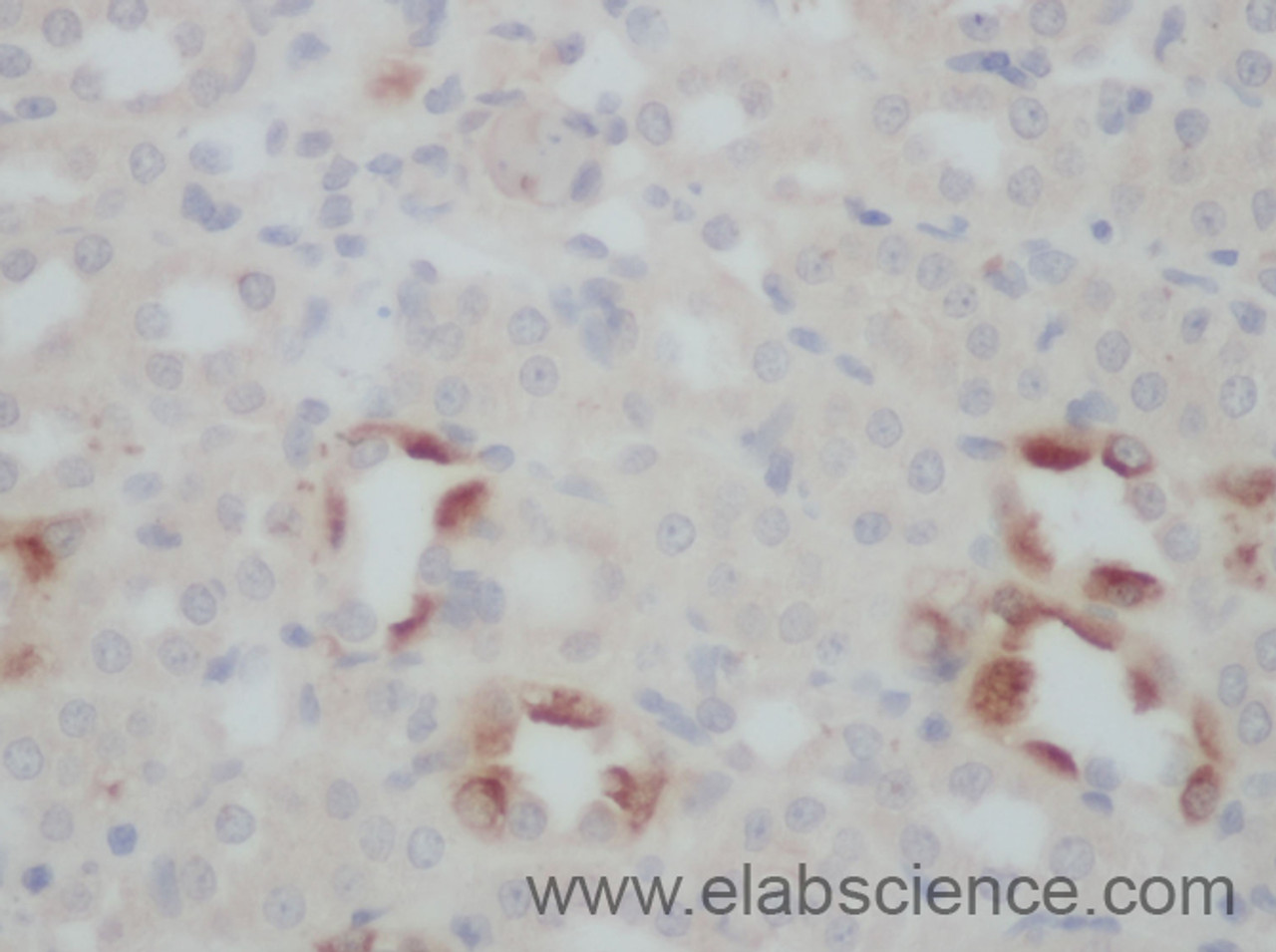 Immunohistochemistry of paraffin-embedded Rat kidney using TNFSF13B Polyclonal Antibody at dilution of 1:50