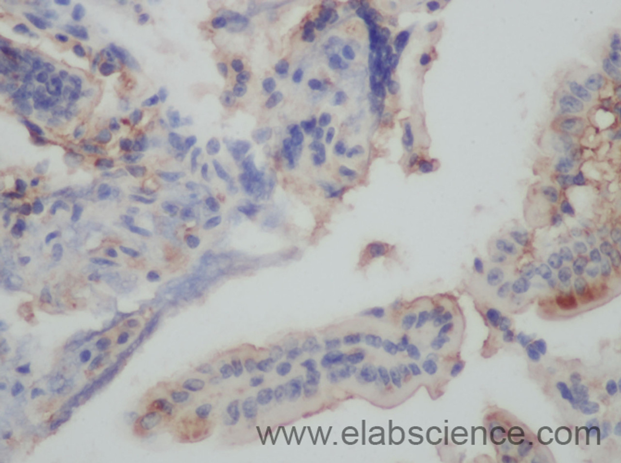 Immunohistochemistry of paraffin-embedded Mouse intestines using MMP13 Polyclonal Antibody at dilution of 1:50