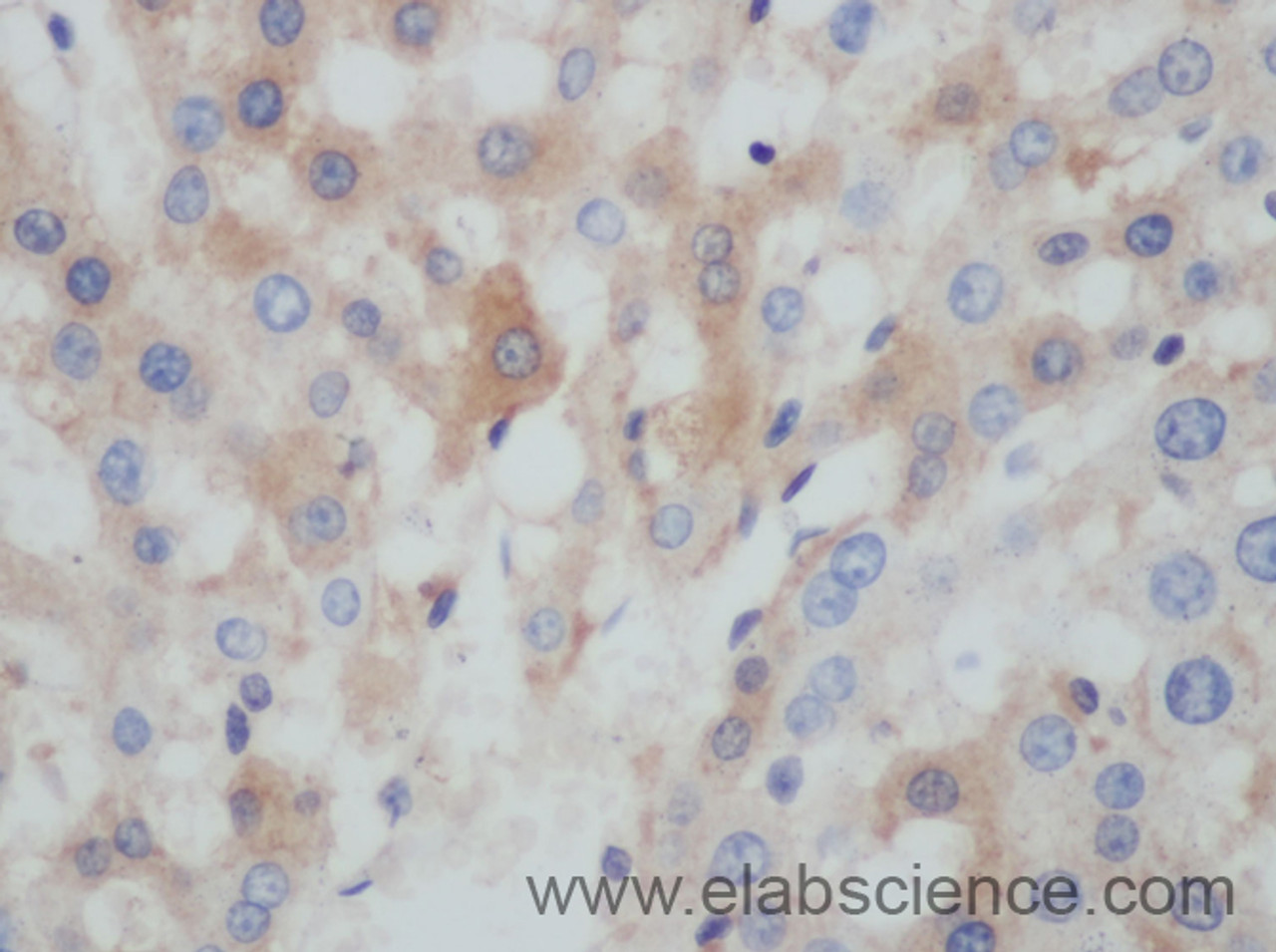 Immunohistochemistry of paraffin-embedded Rat liver using BCL2L15 Polyclonal Antibody at dilution of 1:50
