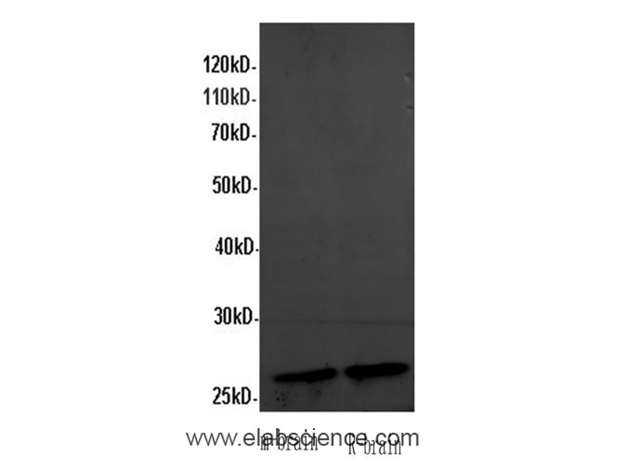 Western Blot analysis of Mouse brain and Rat brain using ANXA5 Polyclonal Antibody at dilution of 1:600