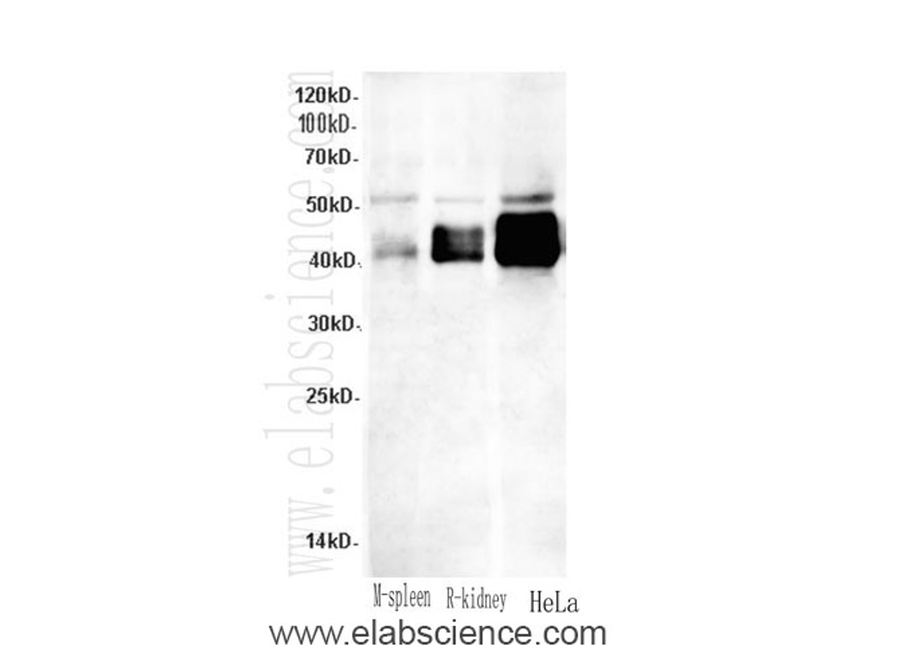 Western Blot analysis of Mouse spleen, Rat kidney and HeLa cells using Casp12 Polyclonal Antibody at dilution of 1:600
