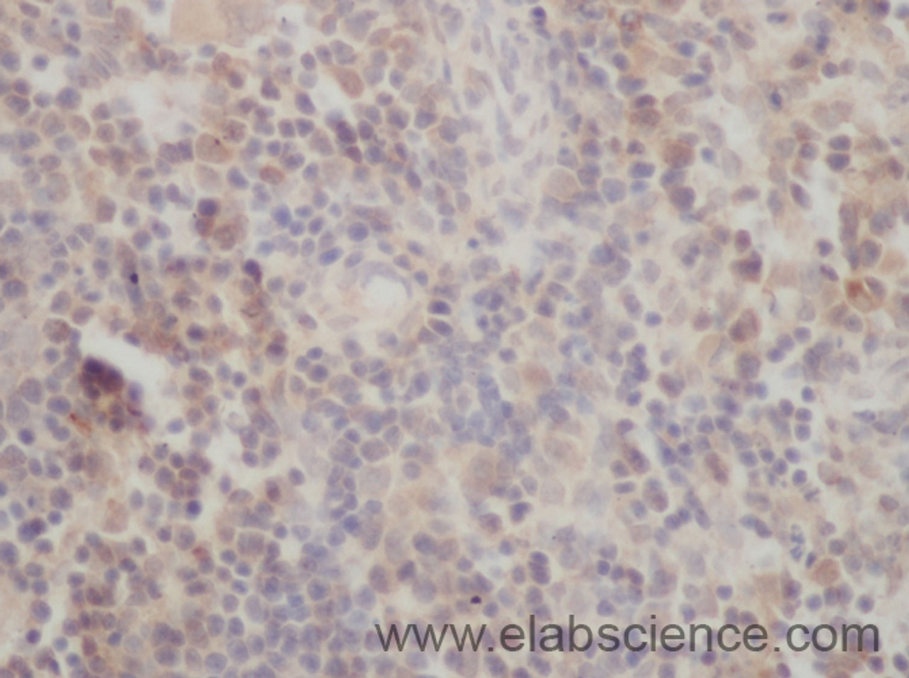 Immunohistochemistry of paraffin-embedded Mouse spleen using P73 Polyclonal Antibody at dilution of 1:50