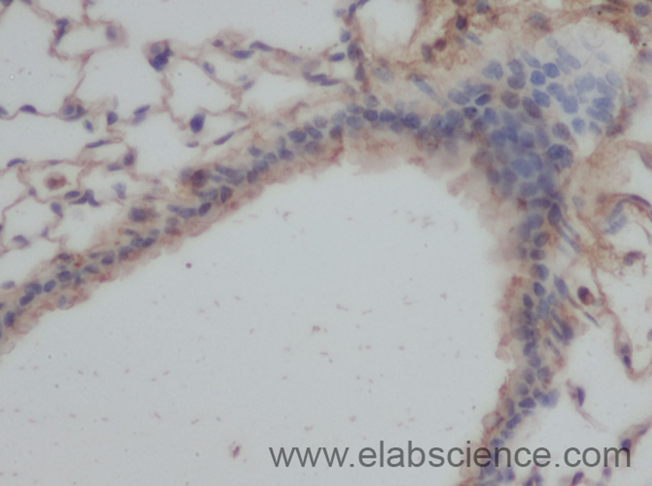 Immunohistochemistry of paraffin-embedded Mouse lung using SERPINE1 Polyclonal Antibody at dilution of 1:50