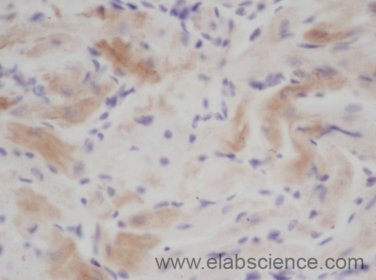 Immunohistochemistry of paraffin-embedded Rat heart using CXCL3 Polyclonal Antibody at dilution of 1:50