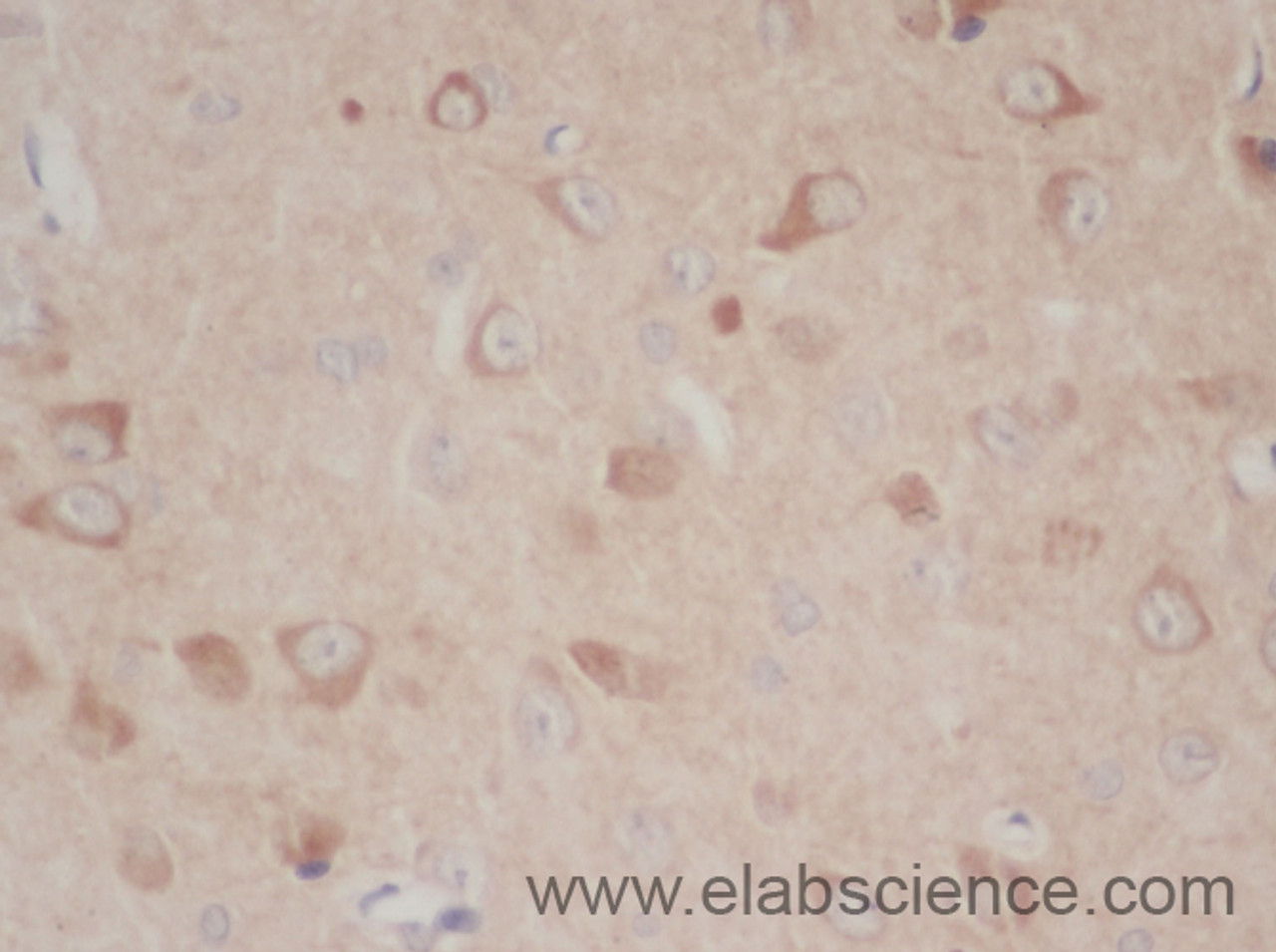 Immunohistochemistry of paraffin-embedded Mouse brain using TLR1 Polyclonal Antibody at dilution of 1:50