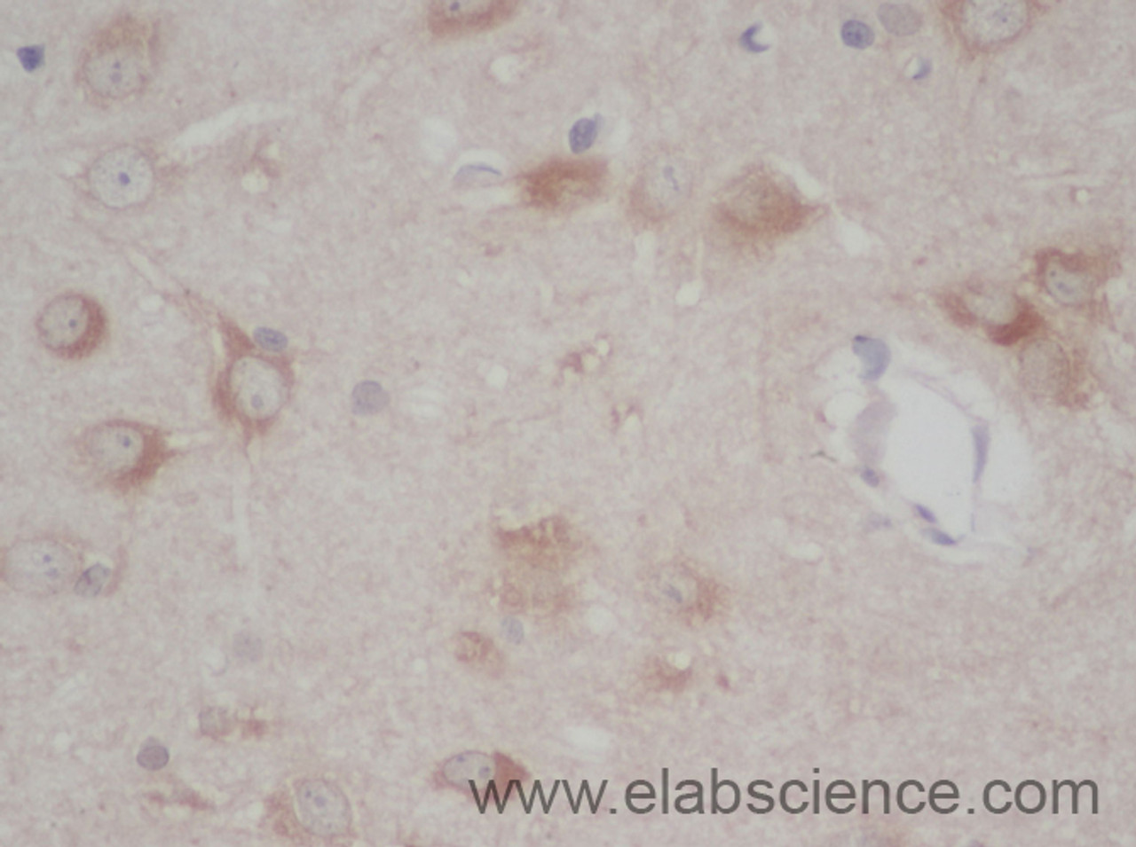 Immunohistochemistry of paraffin-embedded Rat brain using TLR1 Polyclonal Antibody at dilution of 1:50