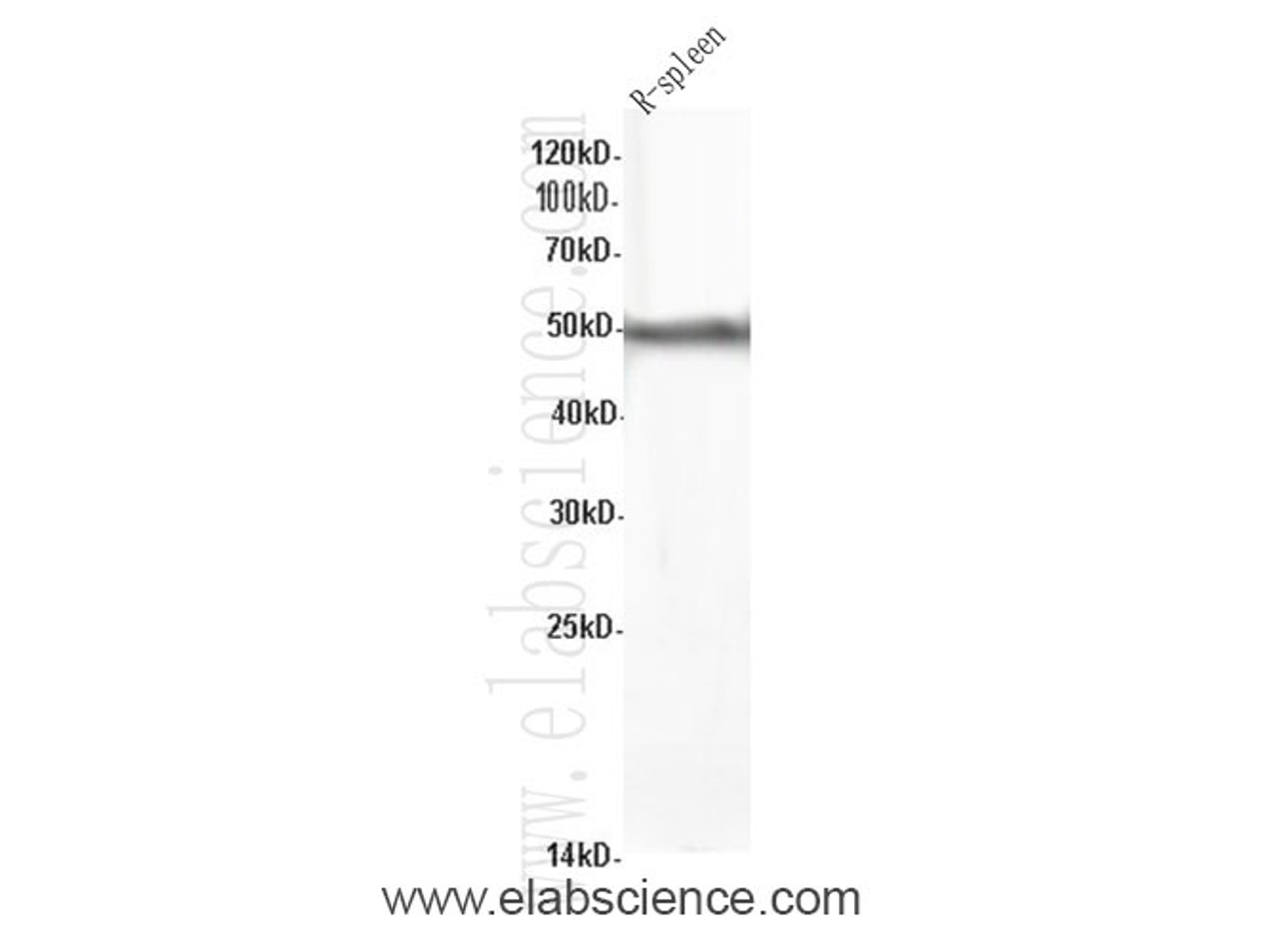 Western Blot analysis of Rat spleen using CORO1A Polyclonal Antibody at dilution of 1:600