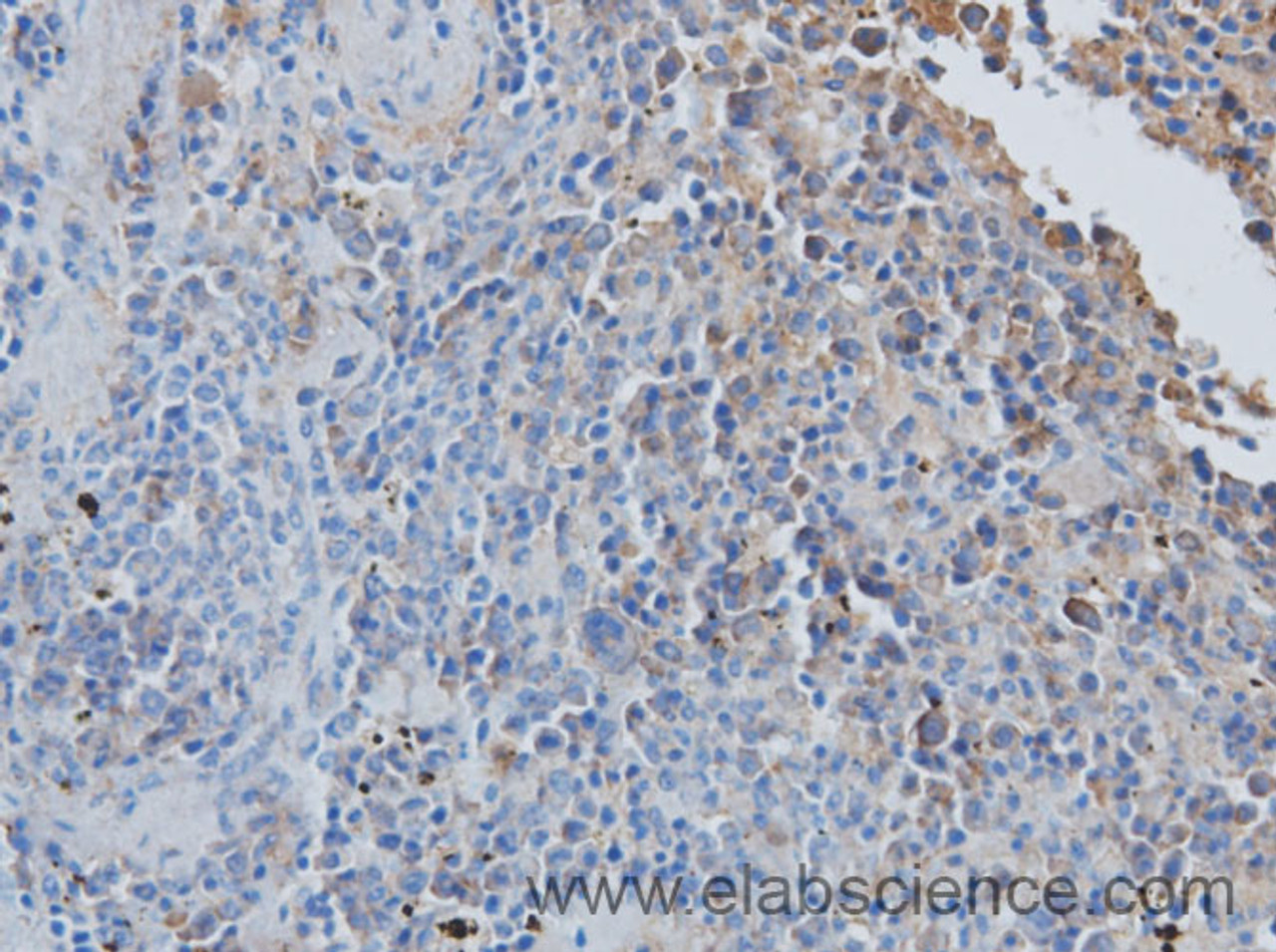 Immunohistochemistry of paraffin-embedded Rat spleen using CCL7 Polyclonal Antibody at dilution of 1:50