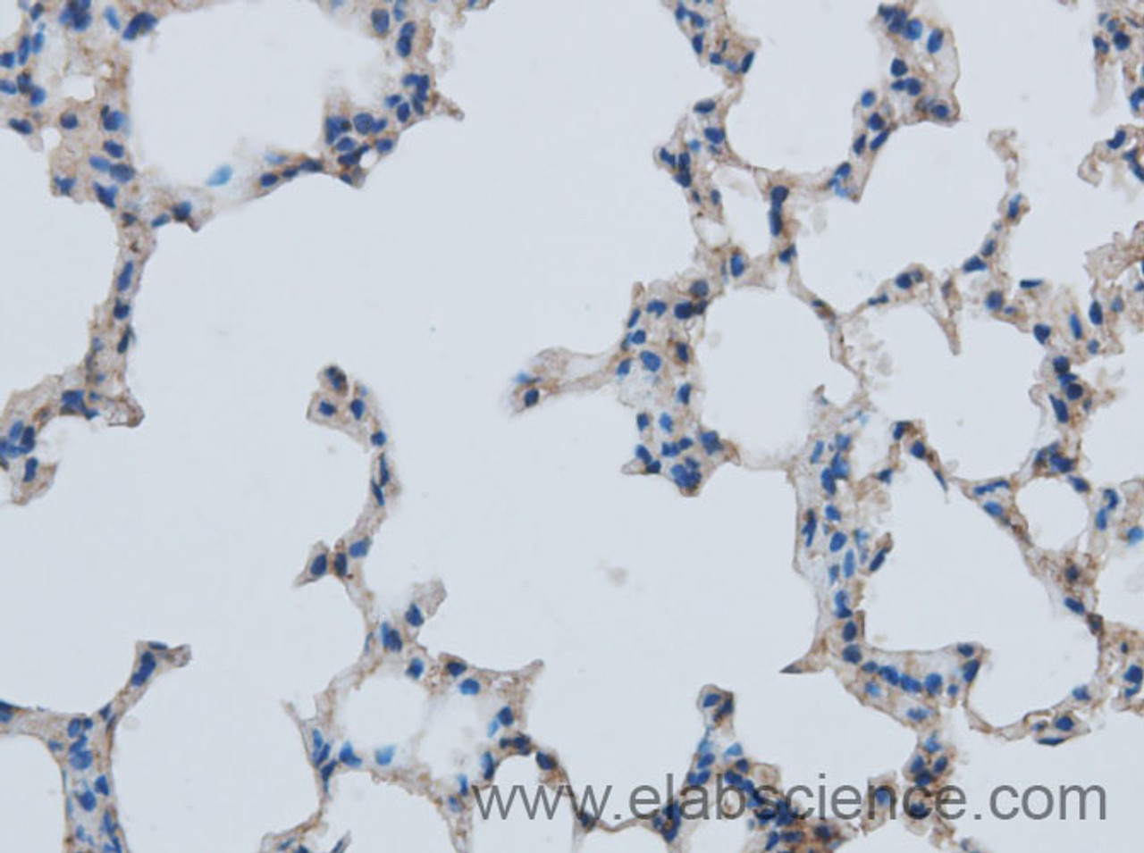 Immunohistochemistry of paraffin-embedded Mouse lung using MMP1 Polyclonal Antibody at dilution of 1:50