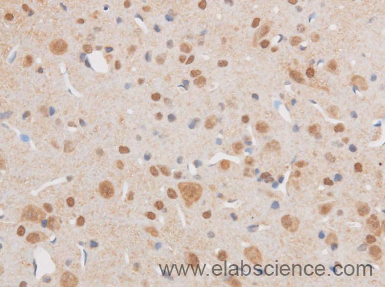Immunohistochemistry of paraffin-embedded Mouse brain using SIX1 Polyclonal Antibody at dilution of 1:50