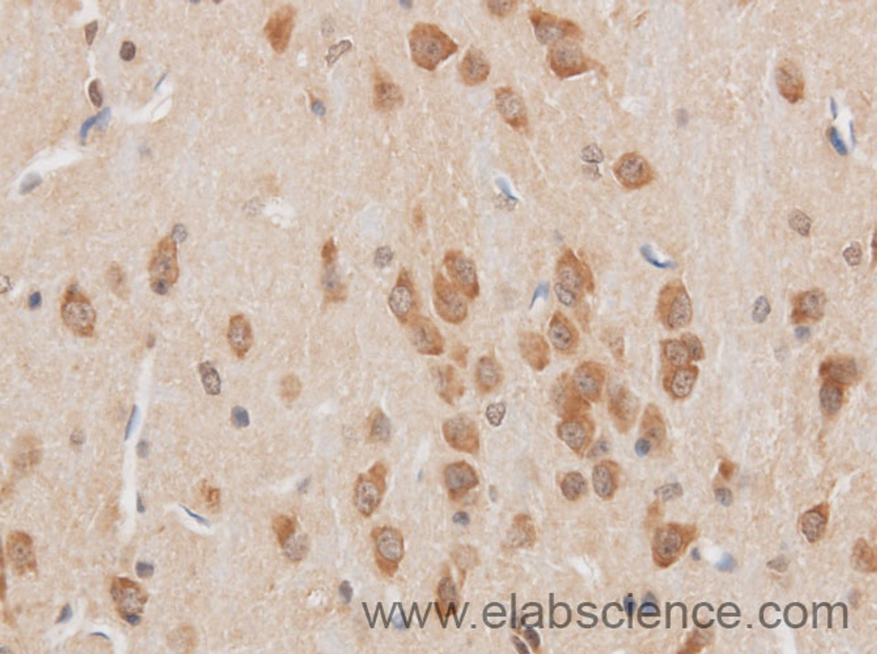 Immunohistochemistry of paraffin-embedded Mouse brain using STOM Polyclonal Antibody at dilution of 1:50