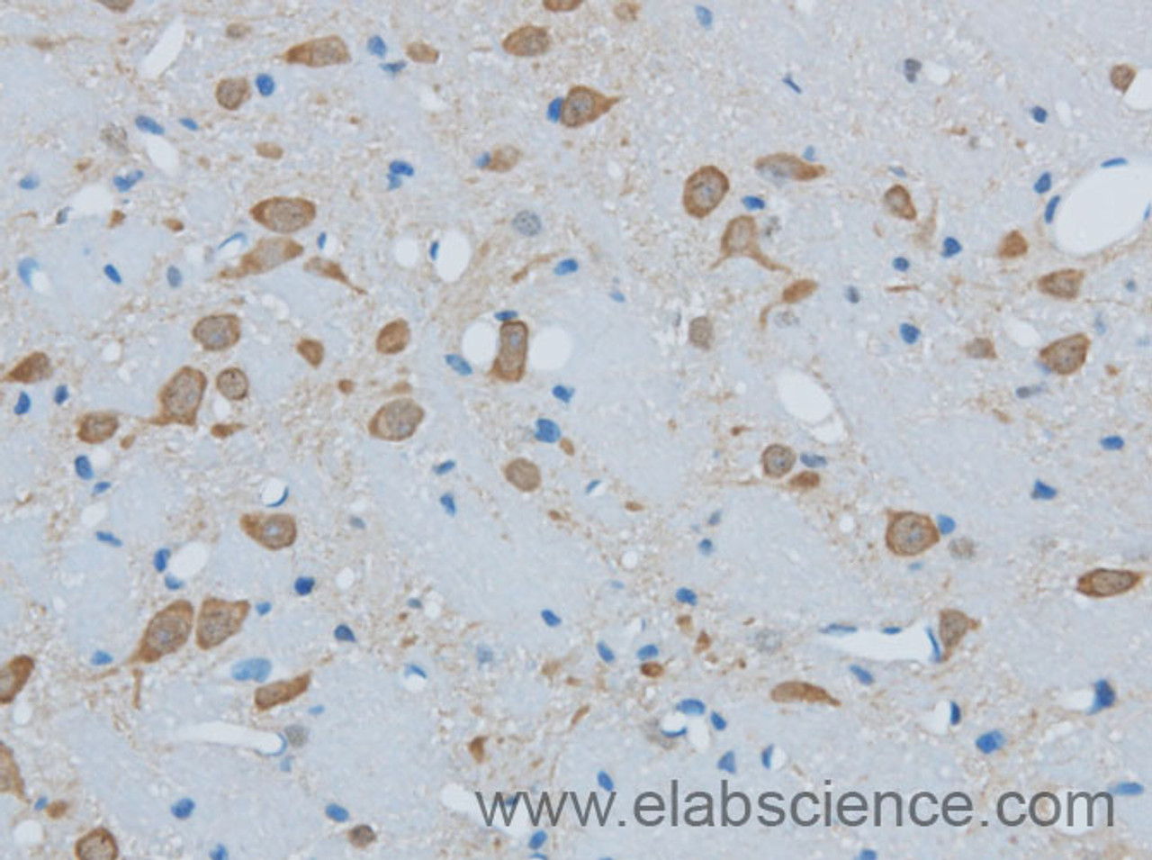 Immunohistochemistry of paraffin-embedded Mouse brain using TIMP4 Polyclonal Antibody at dilution of 1:50