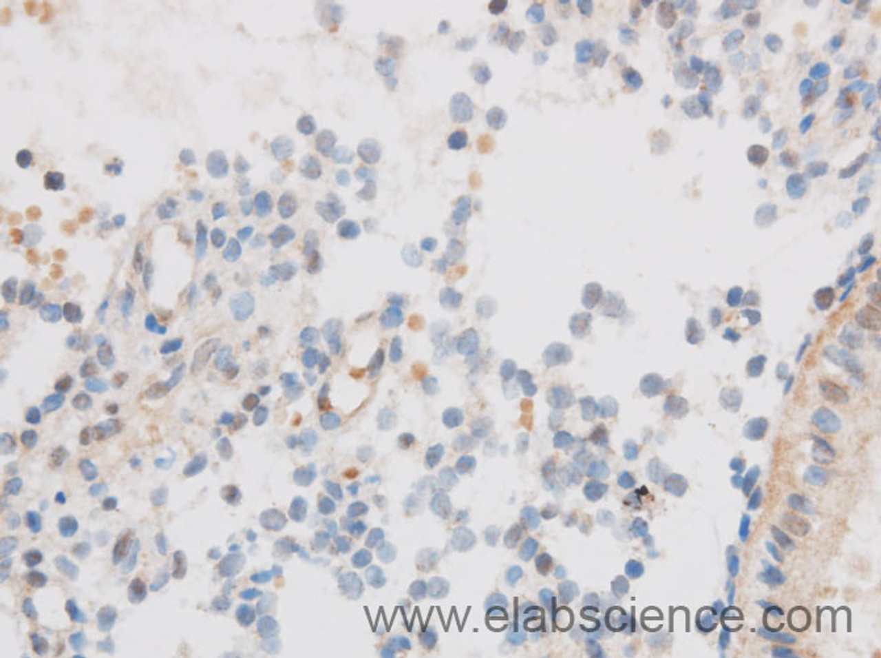 Immunohistochemistry of paraffin-embedded Mouse lung using SIX2 Polyclonal Antibody at dilution of 1:50