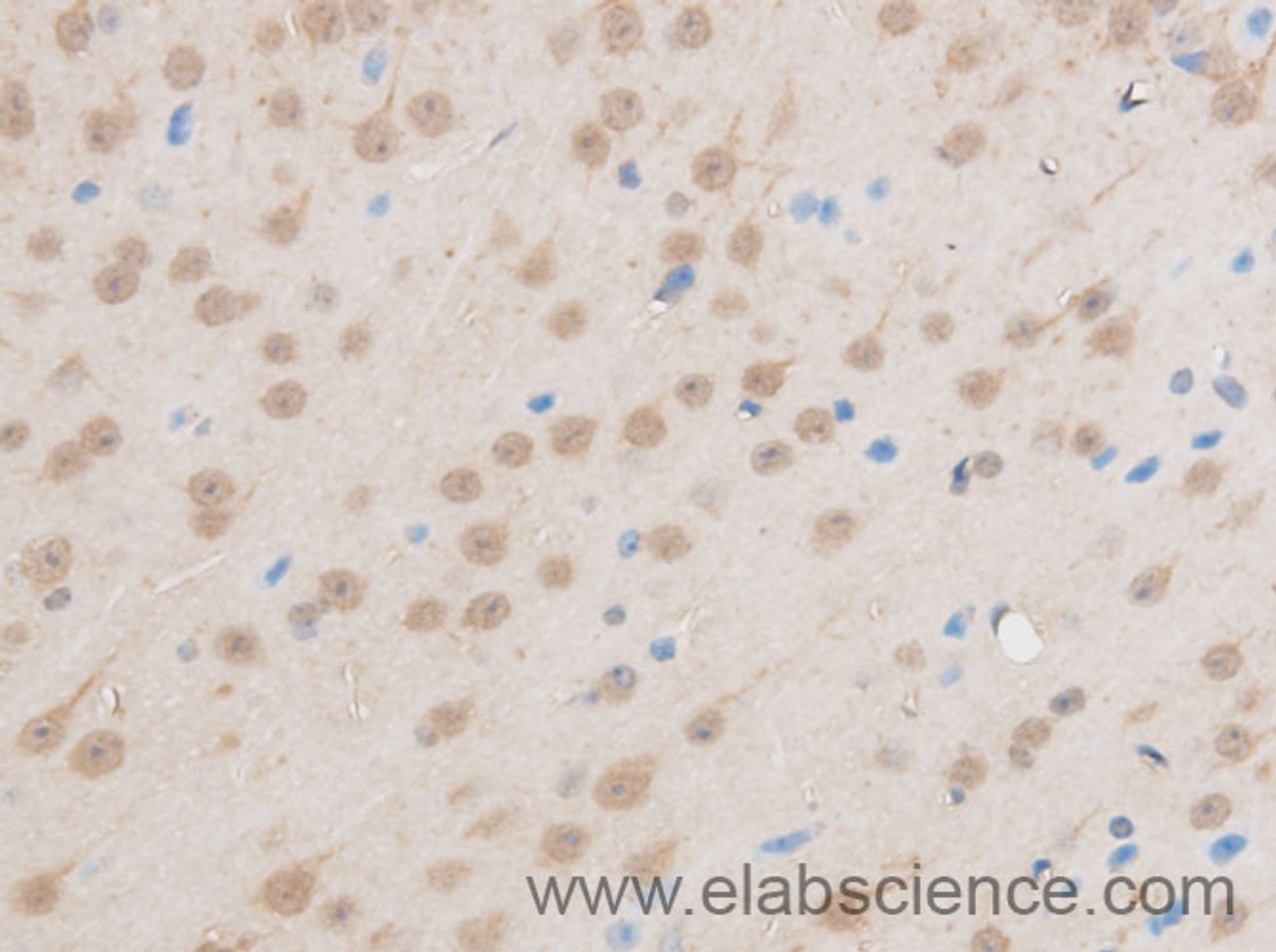 Immunohistochemistry of paraffin-embedded Mouse brain using EIF5A2 Polyclonal Antibody at dilution of 1:50