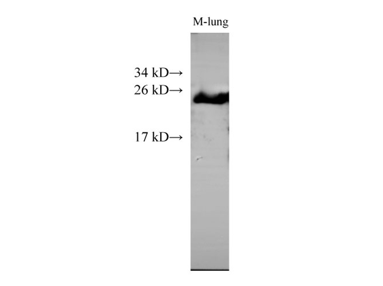 Western Blot analysis of Mouse lung tissue using SNAP25 Polyclonal Antibody at dilution of 1:500