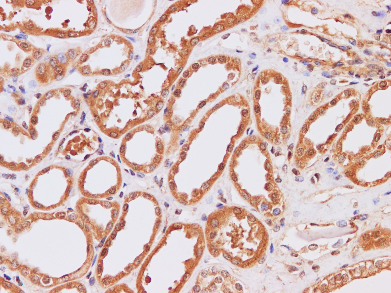 Immunohistochemistry of paraffin-embedded Human kidney using ITPKB Polyclonal Antibody at dilution of 1:200