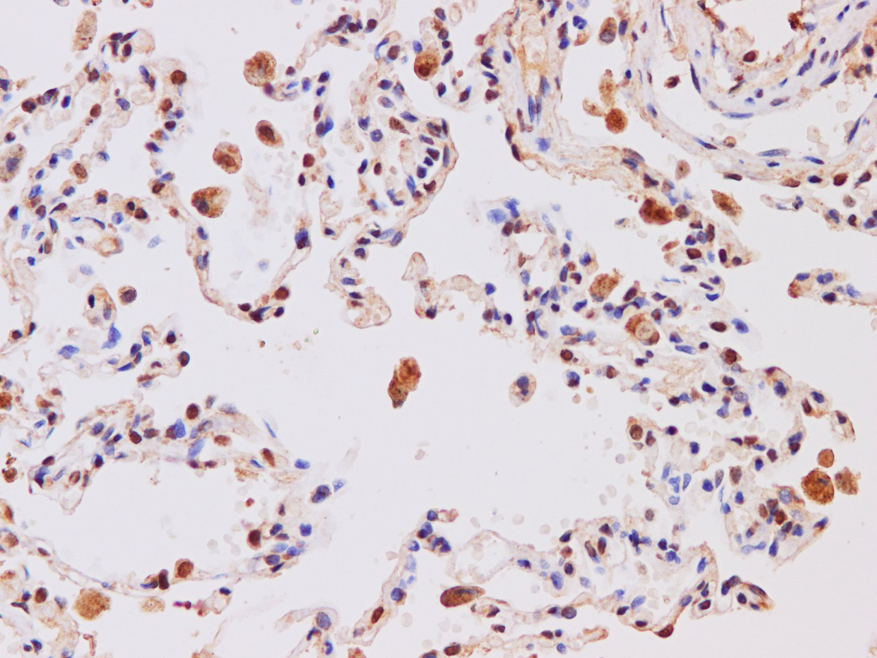 Immunohistochemistry of paraffin-embedded Human lung using IL27 Polyclonal Antibody at dilution of 1:200