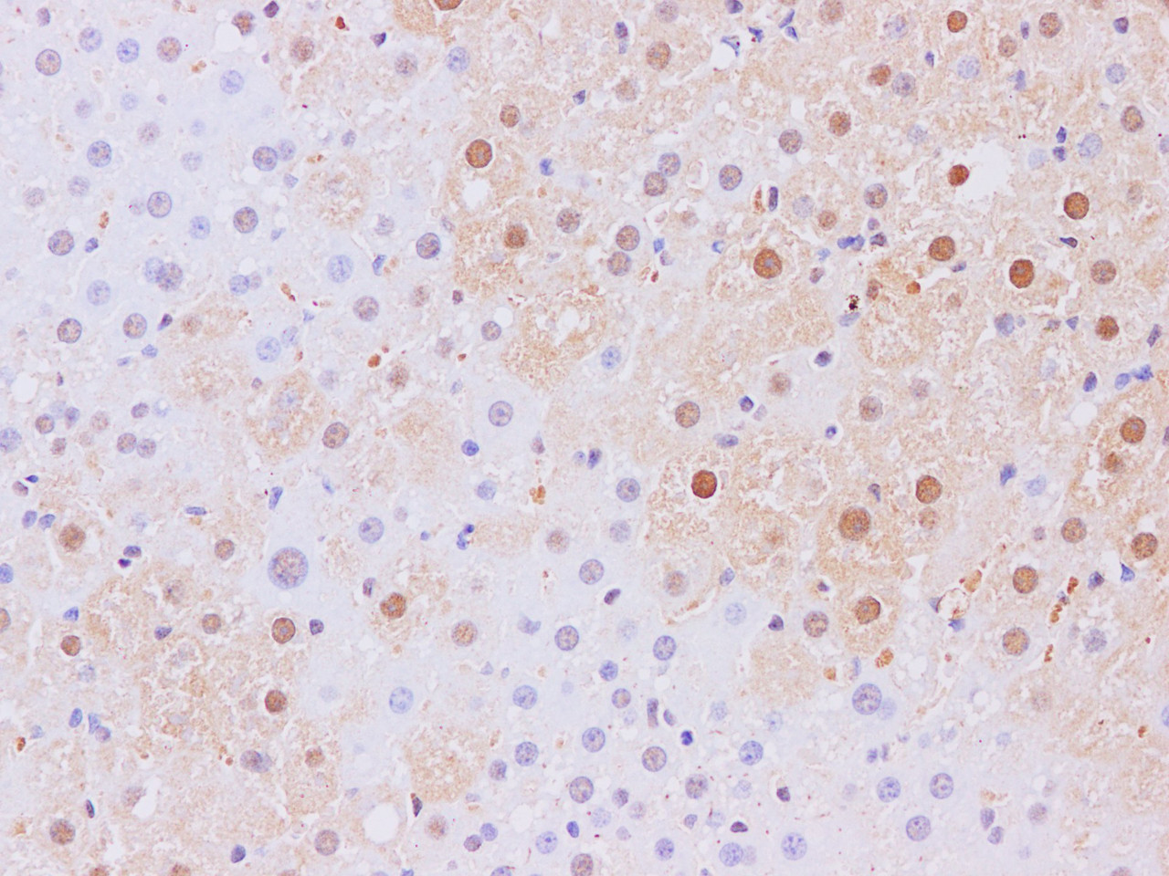 Immunohistochemistry of paraffin-embedded Rat liver using Nr1h3 Polyclonal Antibody at dilution of 1:200