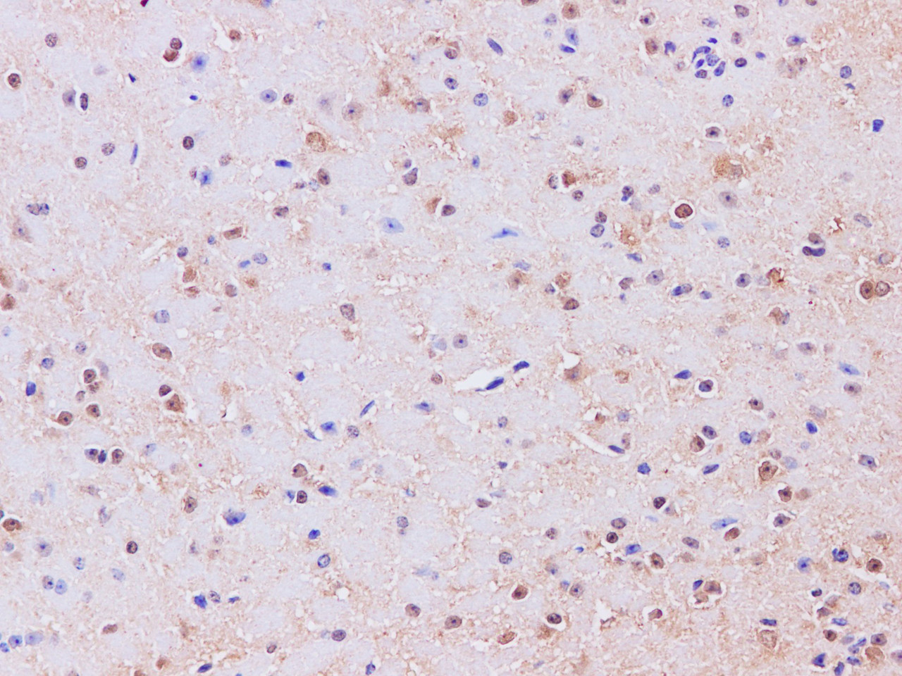 Immunohistochemistry of paraffin-embedded Mouse brain using GAD1 Polyclonal Antibody at dilution of 1:200