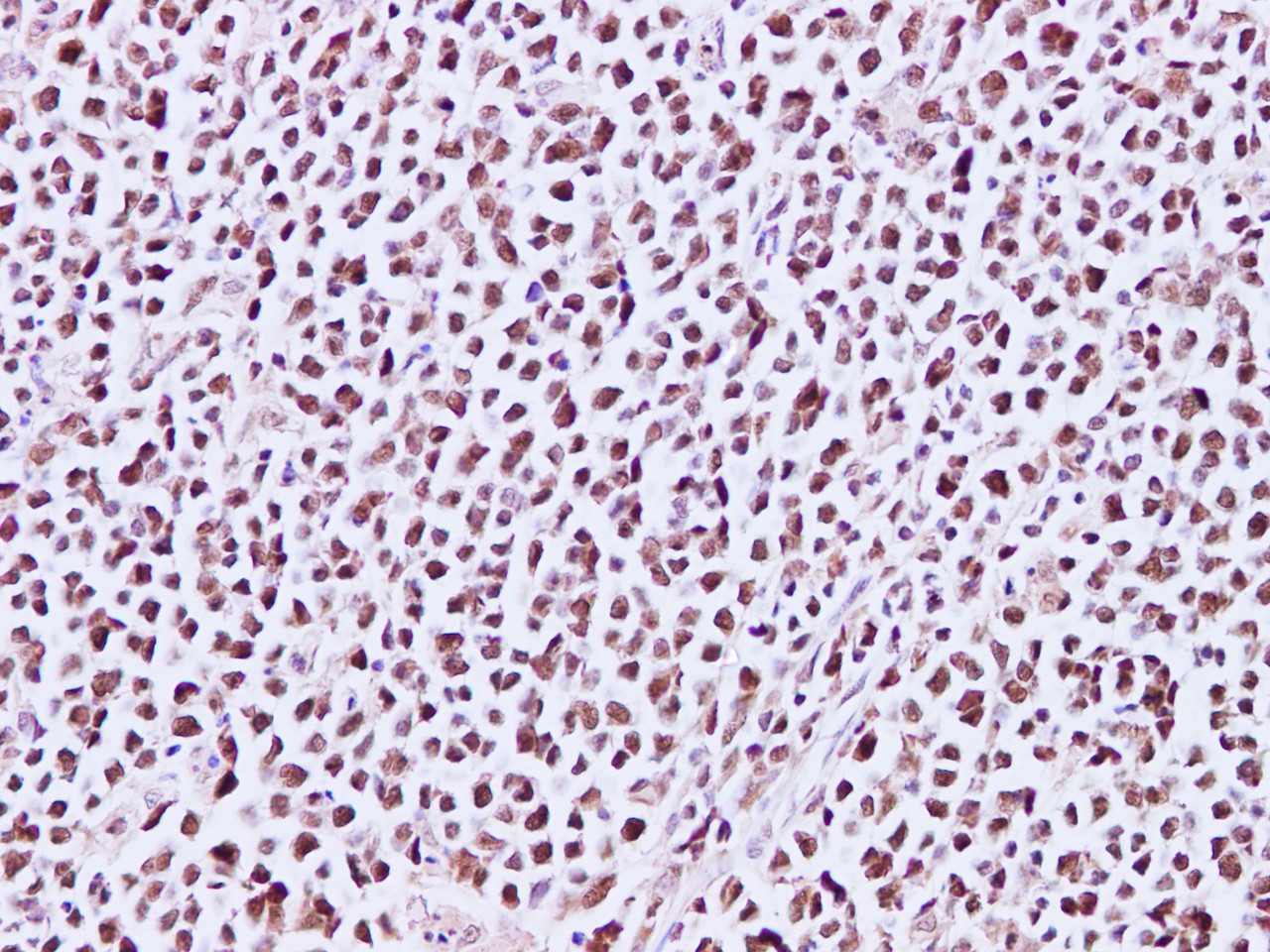 Immunohistochemistry of paraffin-embedded Human lymph node using MCM3 Polyclonal Antibody at dilution of 1:200