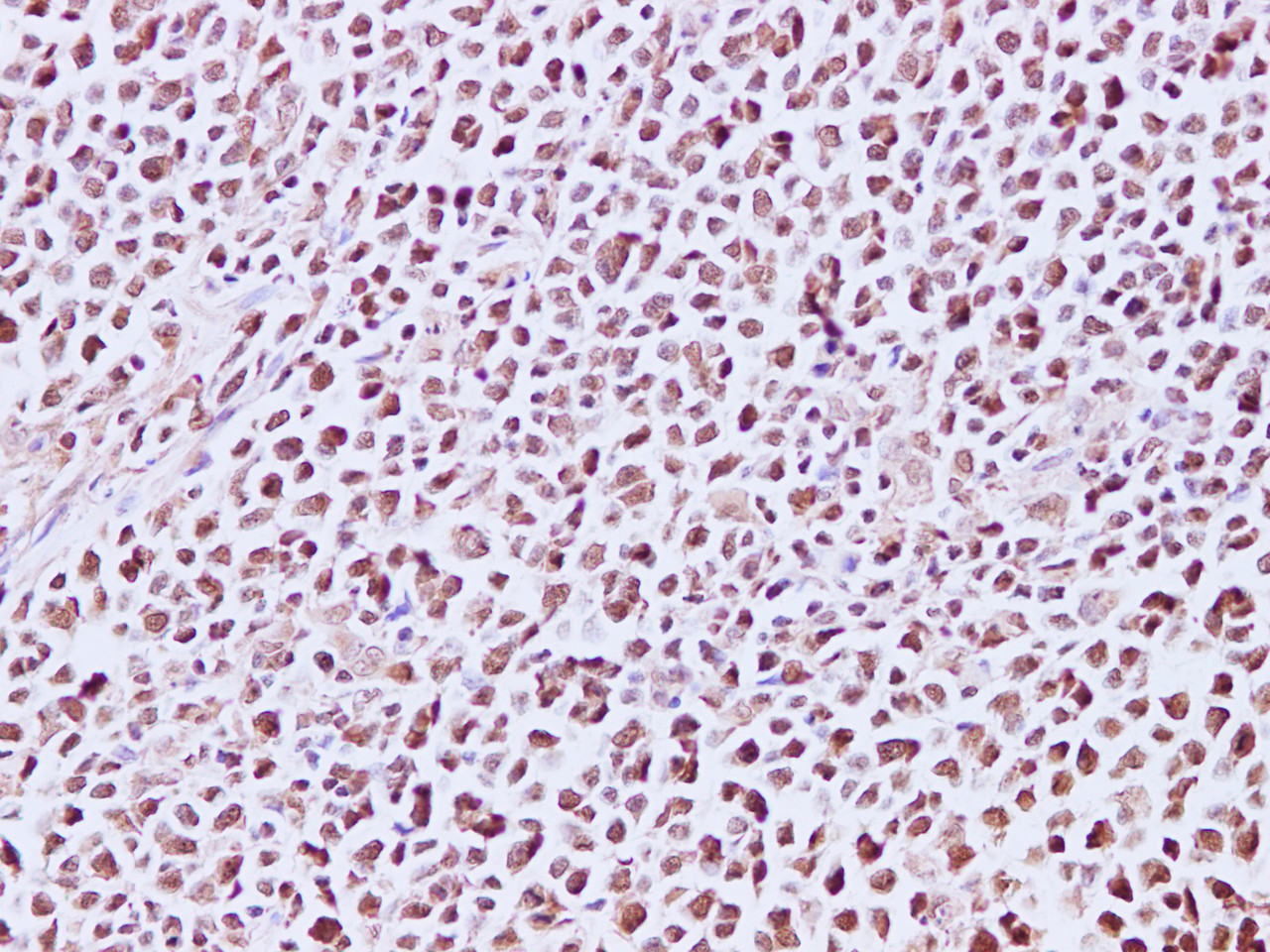 Immunohistochemistry of paraffin-embedded Human lymph node using MCM7 Polyclonal Antibody at dilution of 1:200