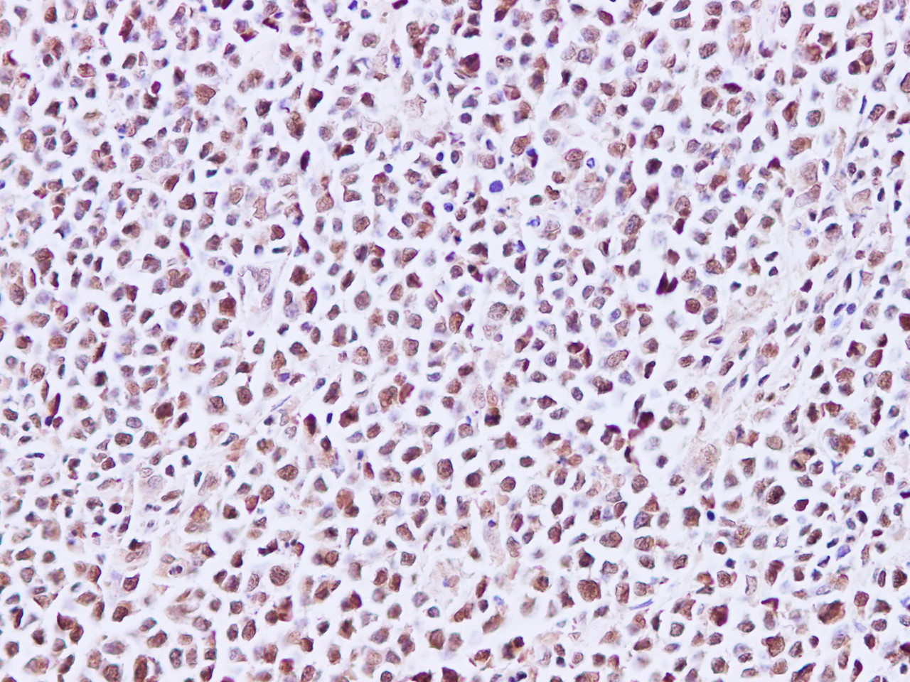 Immunohistochemistry of paraffin-embedded Human lymph node using CDC46 Polyclonal Antibody at dilution of 1:200