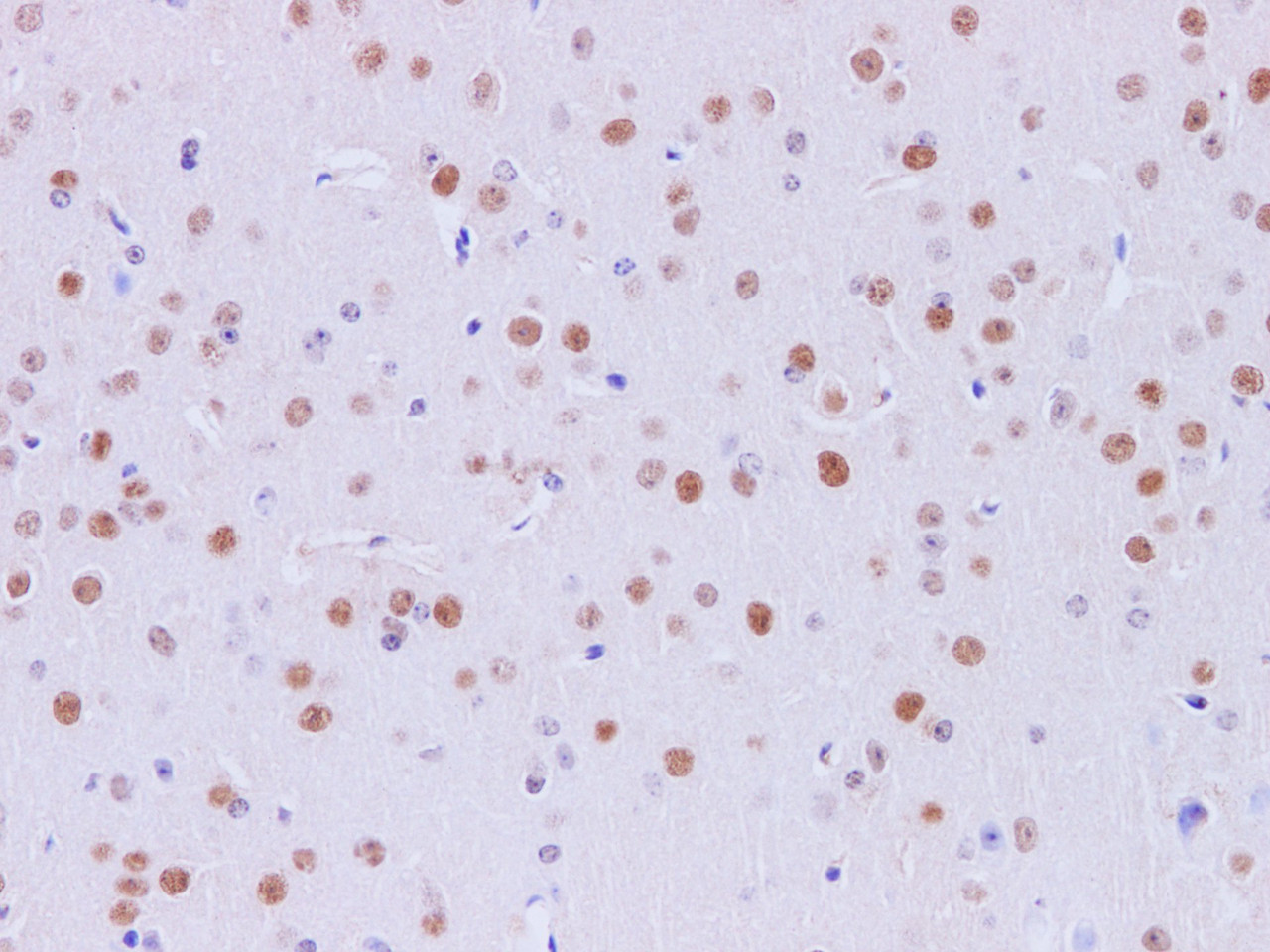 Immunohistochemistry of paraffin-embedded Mouse brain using MEF-2C Polyclonal Antibody at dilution of 1:200