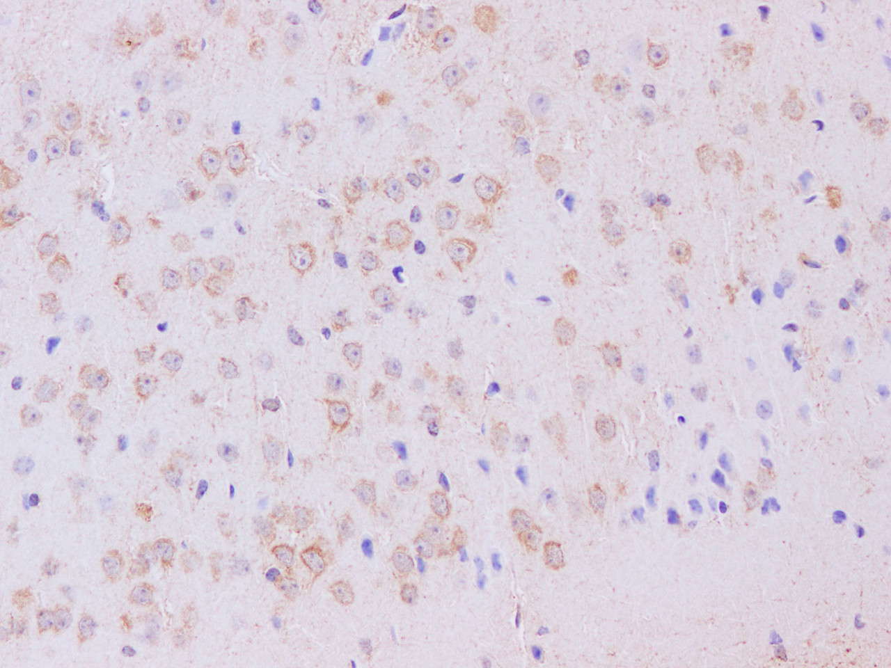 Immunohistochemistry of paraffin-embedded Mouse brain using gamma Tubulin Polyclonal Antibody at dilution of 1:200