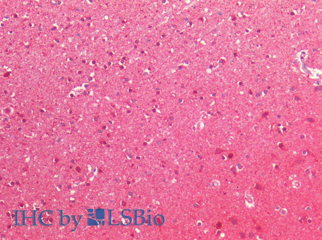 Immunohistochemistry of paraffin-embedded Human cerebral cortex using NEDD8 Polyclonal Antibody at dilution of 1:200(Elabscience® Product Detected by Lifespan).