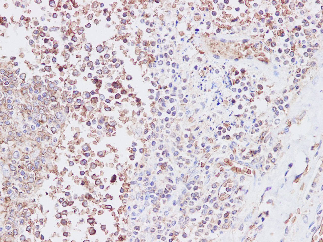 Immunohistochemistry of paraffin-embedded humantonsil using SNAP23 Polyclonal Antibody at dilution of 1:200