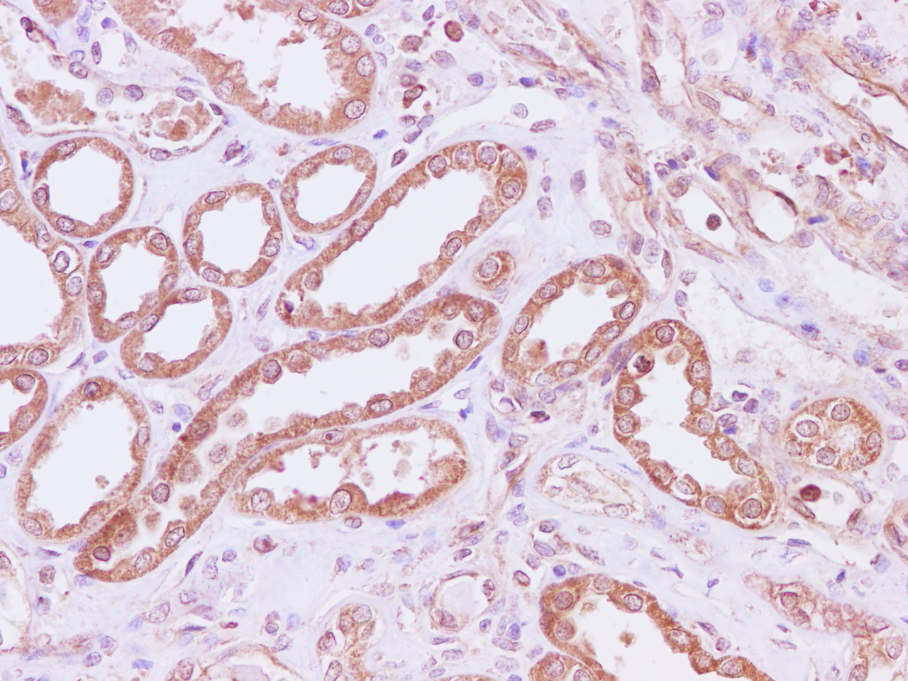 Immunohistochemistry of paraffin-embedded Human kidney using RPLP1 Polyclonal Antibody at dilution of 1:200