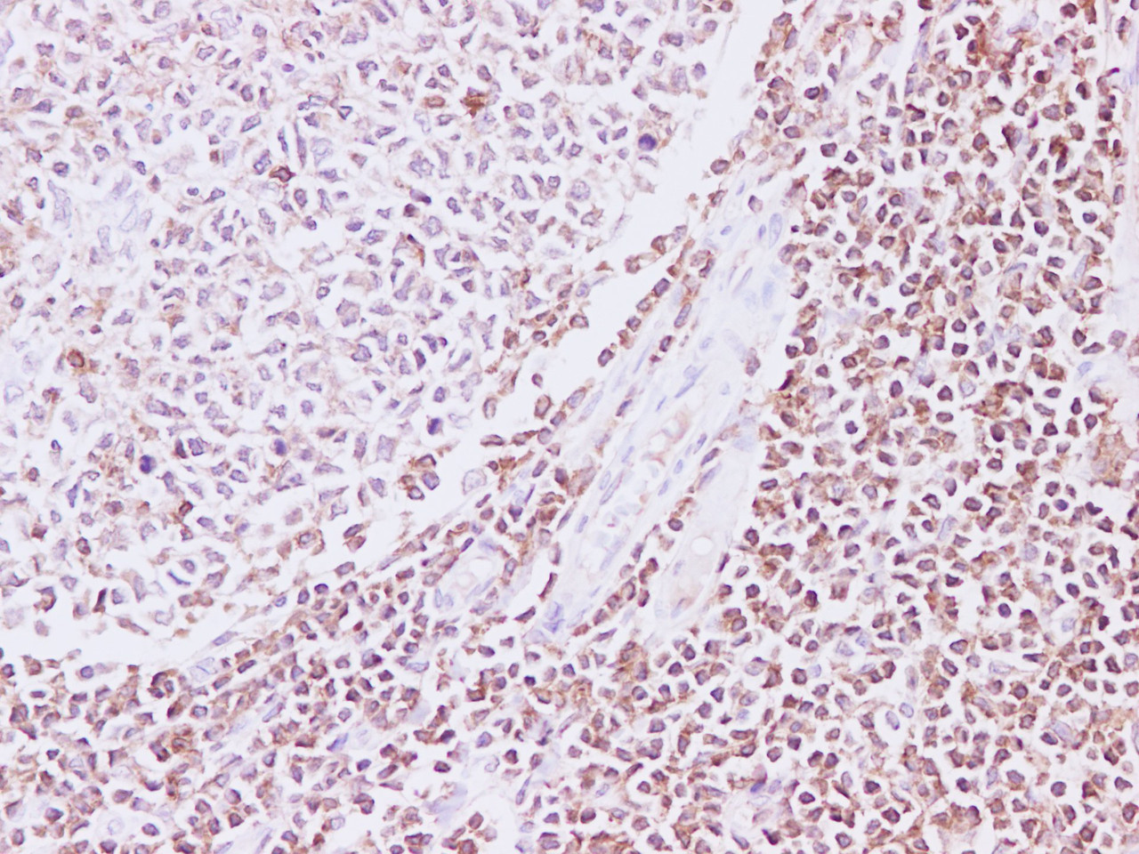 Immunohistochemistry of paraffin-embedded Human Tonsil tissue using RAC2 Polyclonal Antibody at dilution of 1:200