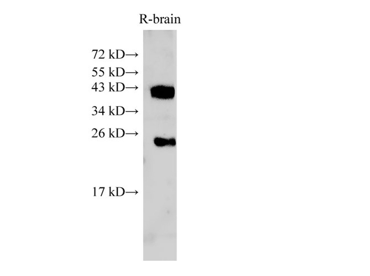 Western Blot analysis of Rat brain tissue using ATXN3 Polyclonal Antibody at dilution of 1:500