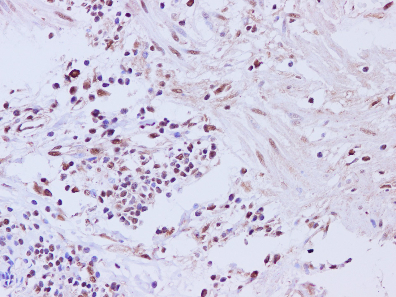Immunohistochemistry of paraffin-embedded Human muscularis mucosa of the colon tissue using CCNL2 Polyclonal Antibody at dilution of 1:200