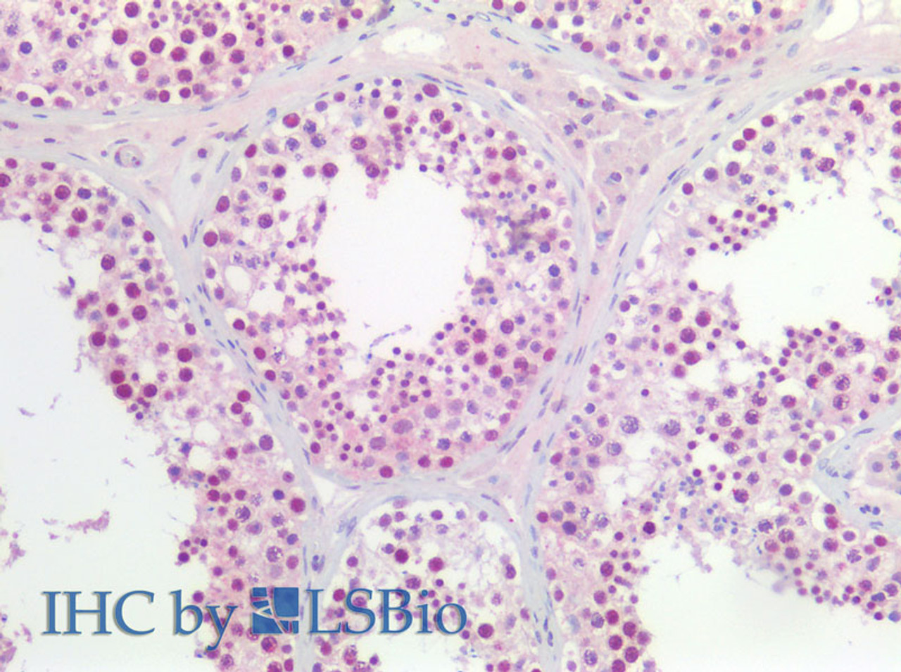 Immunohistochemistry of paraffin-embedded Human testis using CCNL2 Polyclonal Antibody at dilution of 1:200(Elabscience® Product Detected by Lifespan).