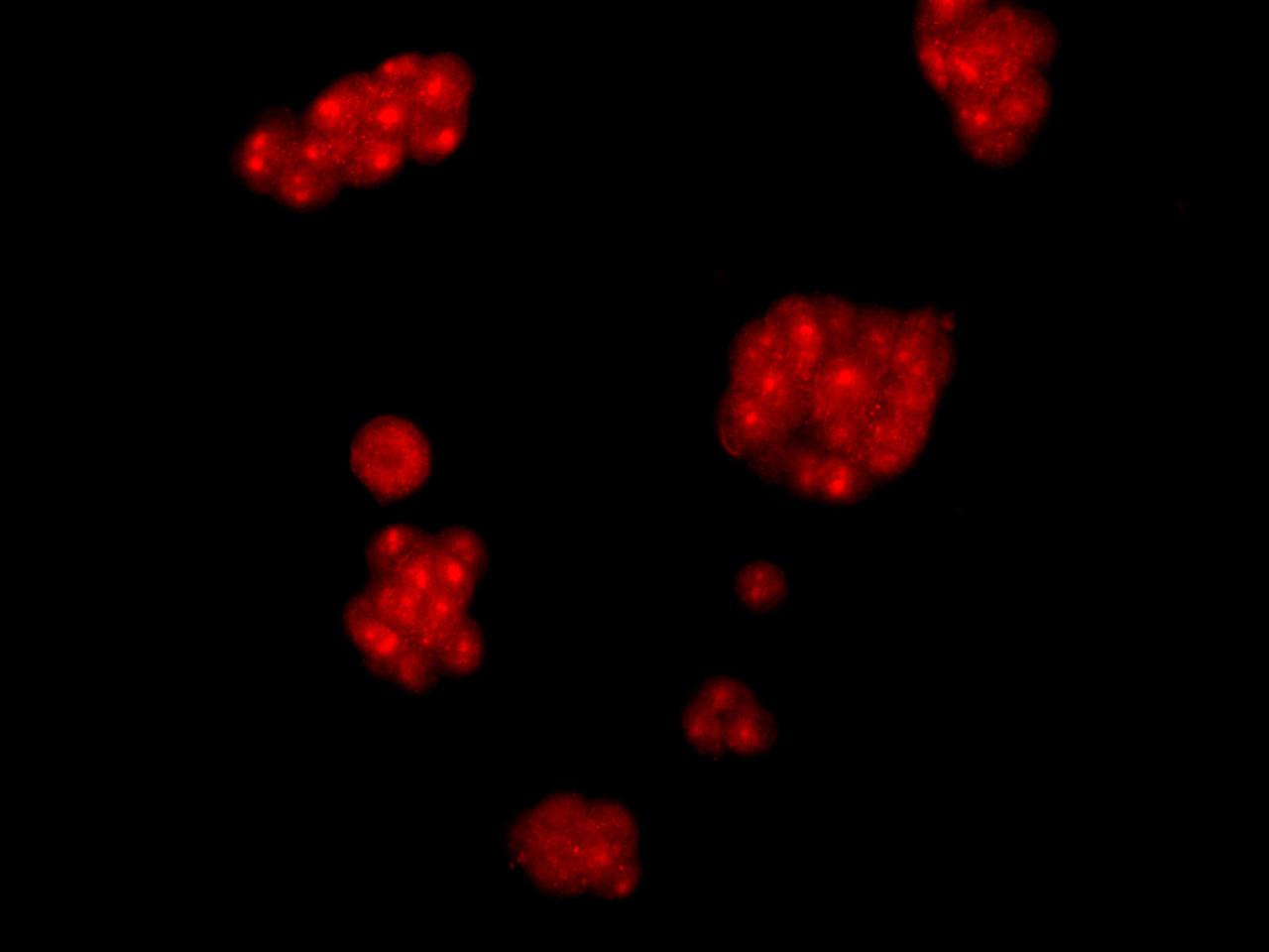 Immunofluorescence analysis of McF7 cells using AMPK alpha2 Polyclonal Antibody at dilution of 1:100